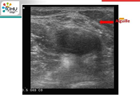 Echographie Pour Le Clinicien Partie Intgrante De Lexamen