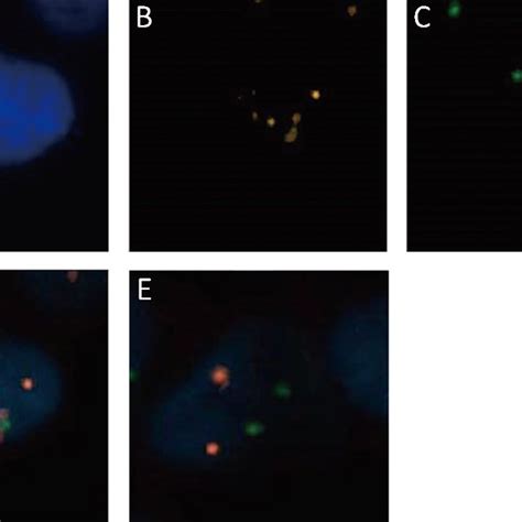 Immune Fluorescence In Situ Hybridization On Chromosomes Cen817 Of