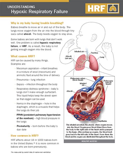 Hypoxic Respiratory Failure (HRF) - NICU Parent Education Resources