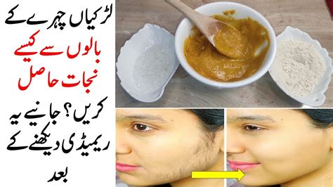 Remove Facial Hair At Home Naturally No Waxing No Threading Huda