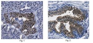 Anti Phospho PDHE1 A Type I Ser300 Antibody From Rabbit Purified By