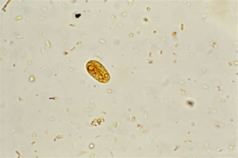 Giardia Lamblia Cyst Under Microscope | Bruin Blog