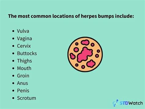 Ingrown Hairs Vs Herpes What S The Difference STDWatch