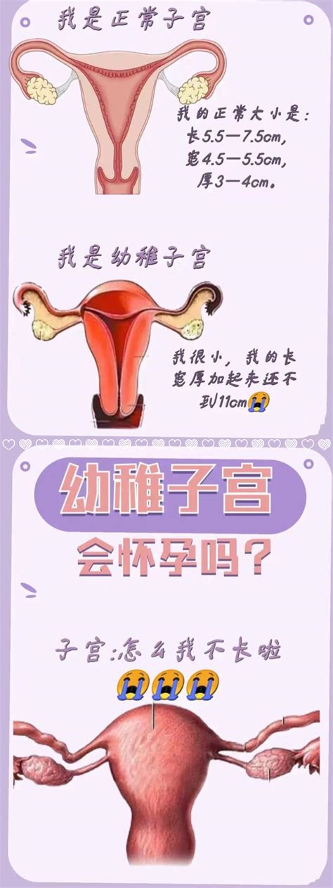 幼稚子宫能怀上宝宝吗？ 知乎