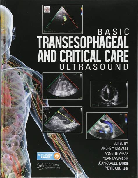 Basic Transesophageal And Critical Care Ultrasound 2017 Critical Care Ebook Online Textbook