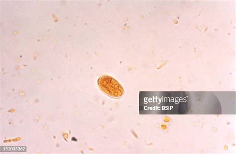 Giardia Lamblia Photos And Premium High Res Pictures Getty Images