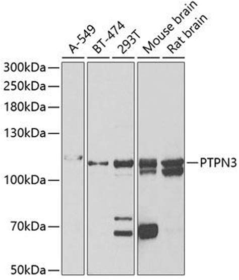 Anti Ptpn3 抗体 Cab6400 Assay Genie