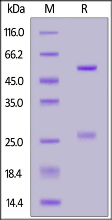 Acrobiosystems Acrobiosystems Biotinylated Anti Sars Cov Spike Rbd