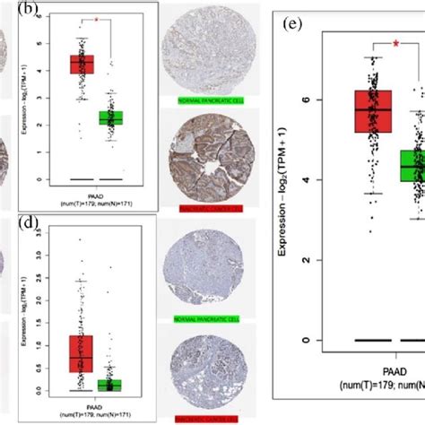 The Mrna And Immune Histochemical Images Of The Hub Gene Protein