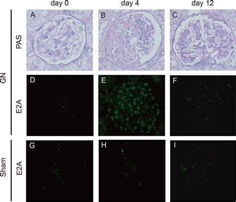 Induction Of Glomerular E2a Expression In Thy 1 Nephritis Download