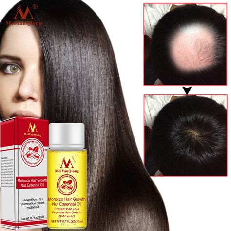 Fast Powerful Hair Growth Essence Hair Loss Gearbeauty