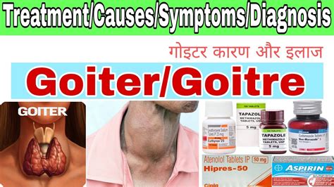 Goiter Treatment In Hindi Goitre Treatmentsymptomscausesdiagnosis गोइटर कारण और इलाज