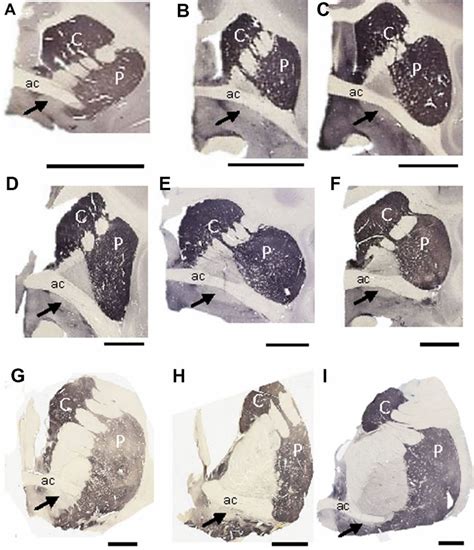 Low Power Photomicrographs Showing Th Immunostained Sections Containing