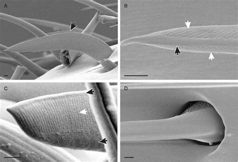 Scanning Electron Micrographs Of Sensilla Trichodea Curvata A