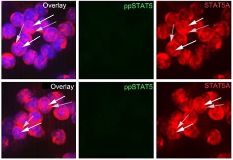 Pattern Of Phosphorylation Of Stat Proteins Isoforms A And B And