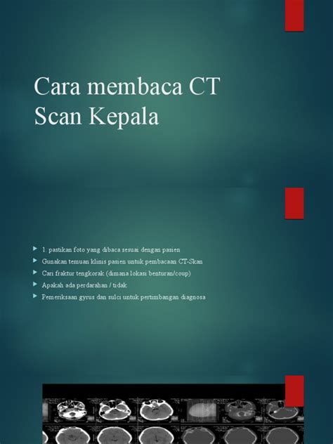 Cara Membaca Ct Scan Kepala Pdf