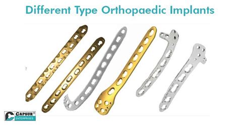 Orthopaedic Implants Different Types Orthopedics Our Body Chosen