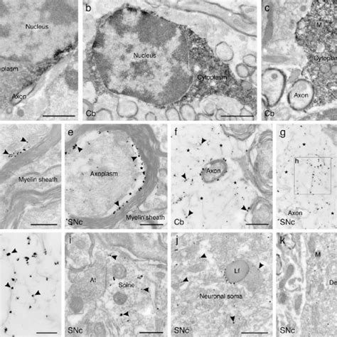 Psi Induced Degeneration In The Olivopontocerebellar System Of
