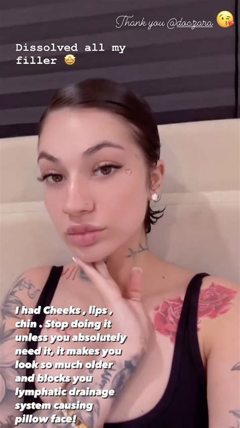 Bhad Bhabie Dissolved Her Fillers Warns People To Stop Getting Them