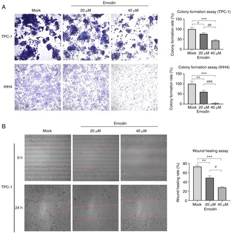 Emodin Treatment Of Papillary Thyroid Cancer Cell Lines In Vitro