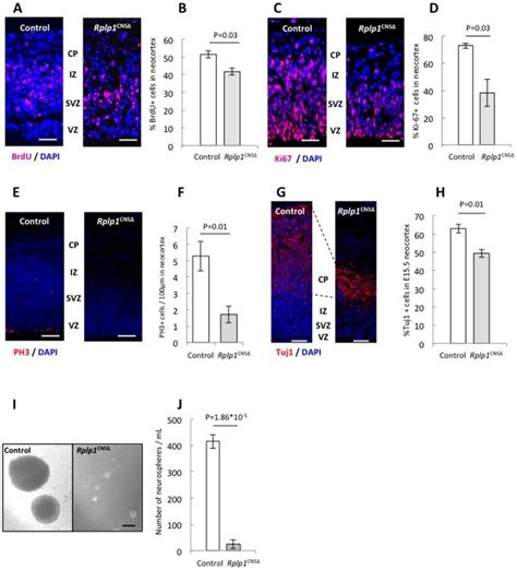 A Brdu Staining Of Control And Rplp1cnsΔ E135 Embryonic Brain