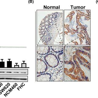 Gpr Knockdown Decreases Dna Synthesis And Expression Of Cell