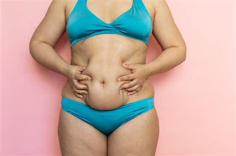 Understanding And Managing Saggy Skin For Weight Loss Move With Marilyn