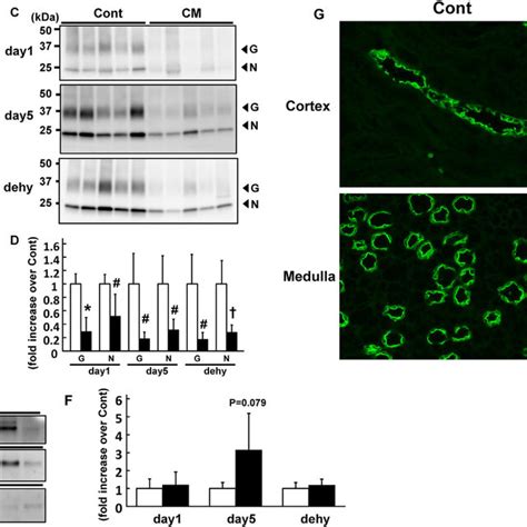 Effects Of CM On The Expression Of Aquaporins In The Kidney And Urinary