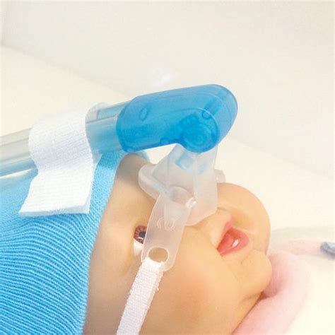 Basmed Silicone Neonatal Bubble Cpap Nasal Mask For Hospital Rs 1300