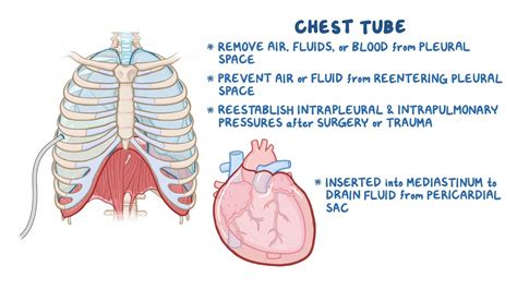Chest Tube Care Nursing Osmosis Video Library