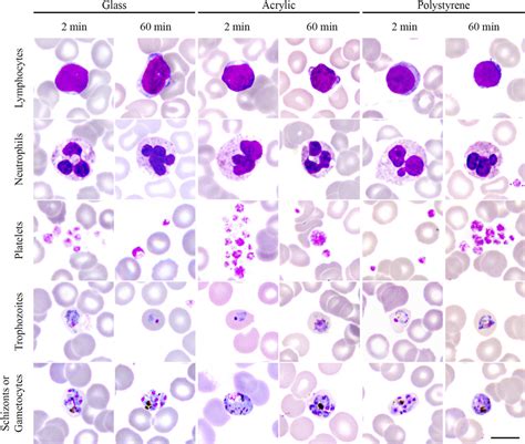 Manual Blood Smears Slides