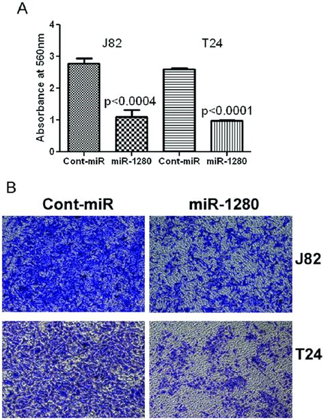 Overexpression Of Mir Inhibits Bladder Cancer Cell Invasion A