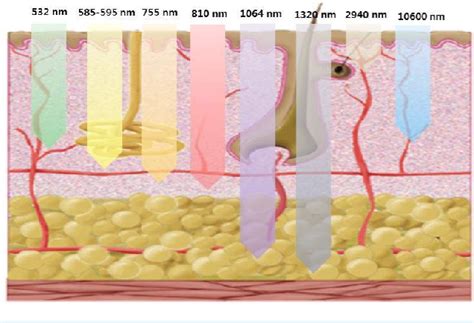 Figure 1 From Development Of A Minimally Invasive And Non Invasive Lipolysis Laser System For