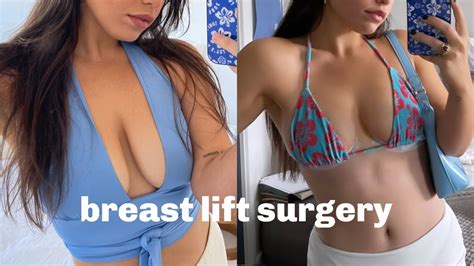 My Breast Lift Surgery Experience Vlog And Qanda Youtube