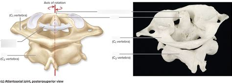 Atlantoaxial Joint Diagram Quizlet