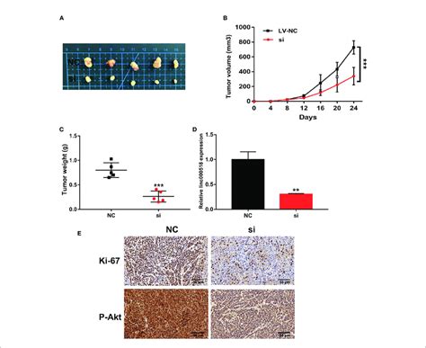 Knockdown Of Linc Inhibits Luad Tumor Growth In Vivo A