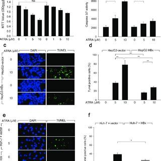 HBx Suppresses ATRA Induced Apoptosis In Human Hepatoma Cells A