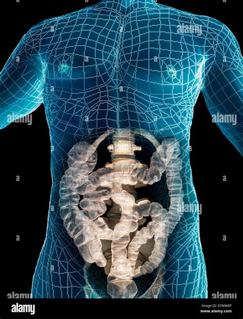 Ct scan abdomen Banque de photographies et dimages à haute résolution