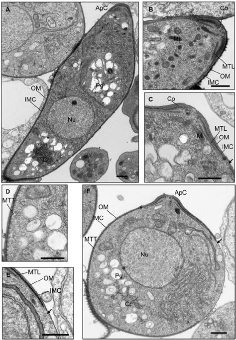 Transmission Electron Micrographs Of Wild Type A B And Pde D Cf