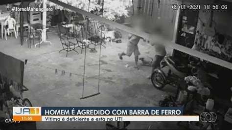 Homem Paralisia Cerebral Agredido Golpes De Barra De Ferro Na