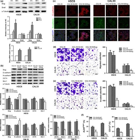 Chemokine Cc Motif Ligand Ccl Induced Epithelial Mesenchymal