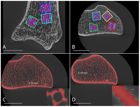 Comparison Of Bone Quality In Middle Ages And Late Modern Period Human