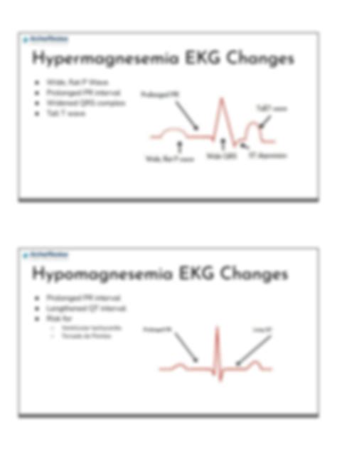 Solution Ekg Changes With Electrolyte Abnormalities Handouts