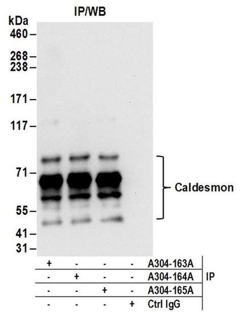 Caldesmon Polyclonal Antibody A304 165a