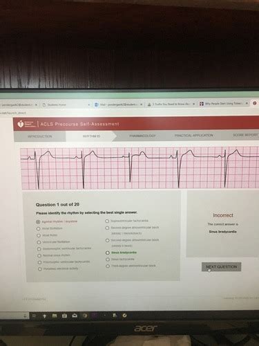 Acls Rhythm Flashcards Quizlet