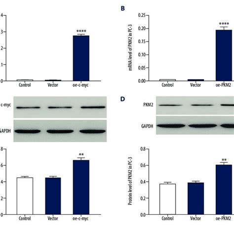 Down Regulation Of Nfatc1 In Pca Cells By Lentivirus Infection Pca