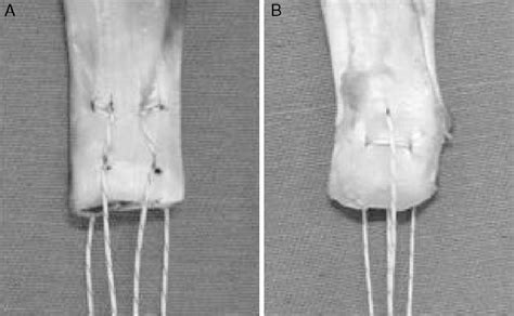 SciELO Brasil Biomechanical Evaluation Between The Modified Mason