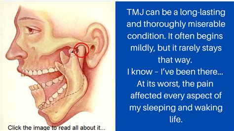 How 4 Tmj Relief Exercises Quickly Treat Jaw Pain Causes And Symptoms