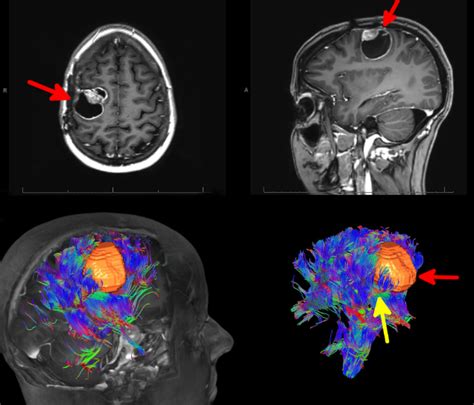 Mri Part Advantage Disadvantage Of Mri Magnetic Resonance Hot Sex Picture