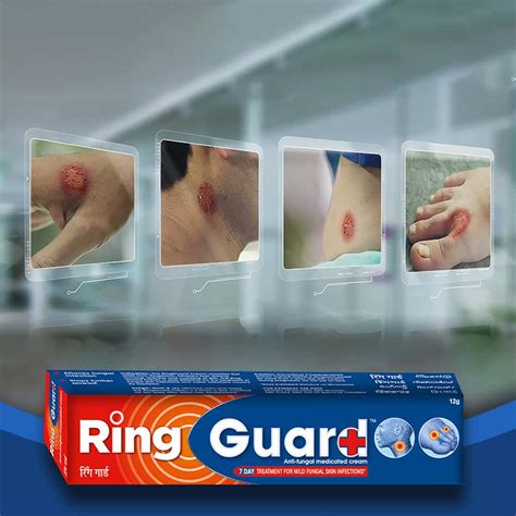 Buy Ring Guard Anti Fungal Cream Tube Of Gm Online Get Upto Off